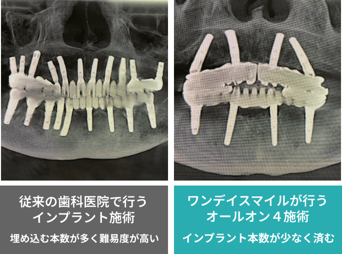 従来の歯科医院 ワンデイスマイル